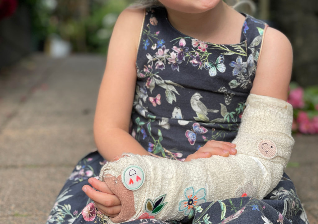 plaster cast care urgent care Auckland