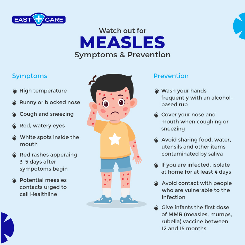 Measles symptoms and preventions